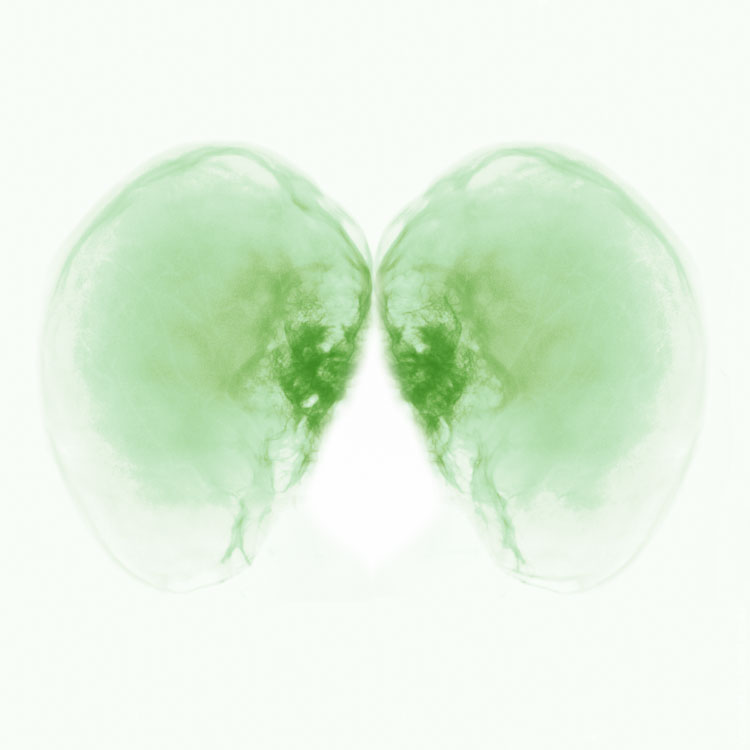Digitalis - Fotografie und Anatomie in der Digitalen Evolution - gesunde Lunge (weil grün)